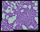 Listeria monocytogenes microscopic image